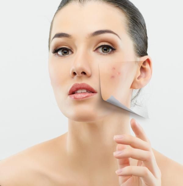 Tecnología Lumecca IPL para eliminación de manchas